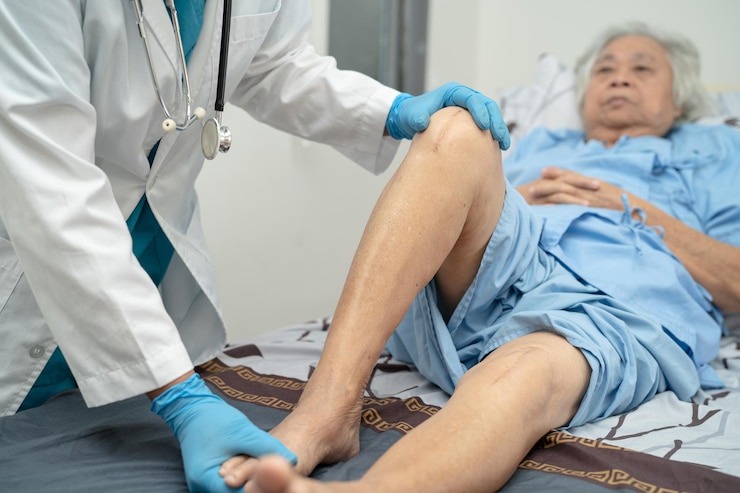 La Maladie de Charcot La Maladie de Charcot